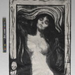 Madonna, skadet